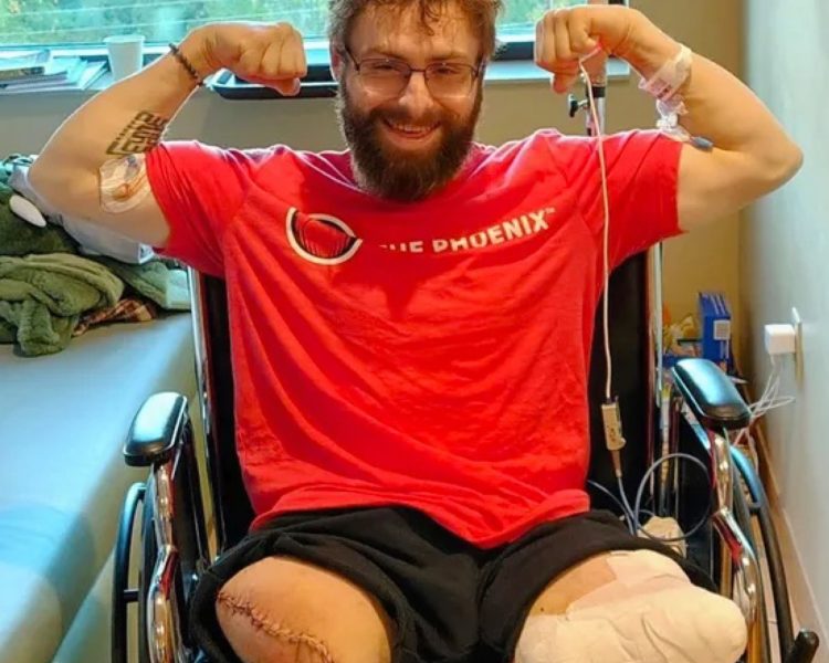 Tree Work Tragedy: Colorado Man Loses Legs in Wood Chipper Accident on First Day