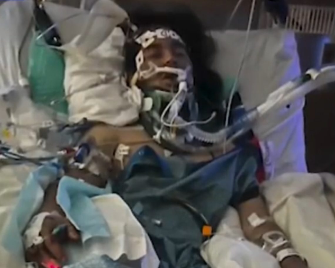 VIDEO Brighton Hit-and-Run Leaves 22-Year-Old in Critical Condition; Family Asks for Help
