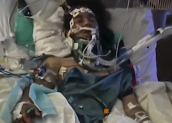 VIDEO Brighton Hit-and-Run Leaves 22-Year-Old in Critical Condition; Family Asks for Help