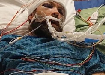 Westminster Man Left Unconscious After Brutal Assault on 120th Avenue – Police Seek Suspects