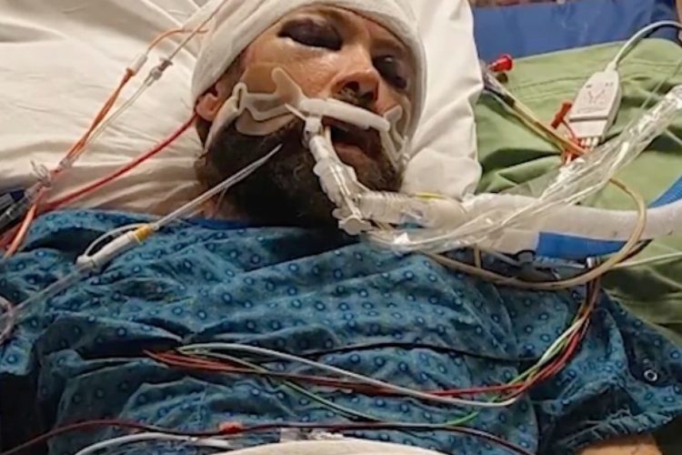 Westminster Man Left Unconscious After Brutal Assault on 120th Avenue – Police Seek Suspects
