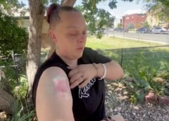 Stray Bullet Hits Aurora Woman in Her Own Home—Police Seek Answers