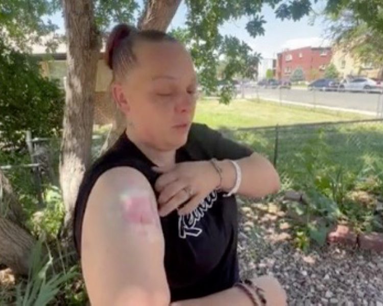 Stray Bullet Hits Aurora Woman in Her Own Home—Police Seek Answers